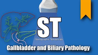 Gallbladder and Biliary Pathology [upl. by Weatherby]