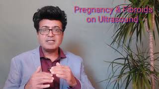 Fibroids during pregnancy and its consequences [upl. by Cori]