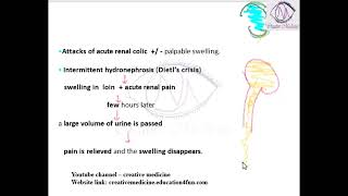 Lec 4 Hydronephrosis Clinical Features [upl. by Cristine]