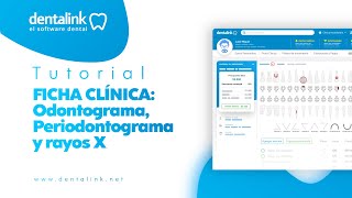 AÑADIR DIAGNÓSTICOS EN ODONTOGRAMA PERIODONTOGRAMA Y RAYOS X EN DENTALINK [upl. by Julianna]