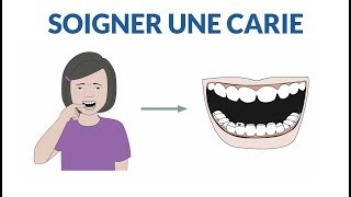 Comment soigner une dent cariée [upl. by Arella394]