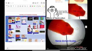 practical Cestode and trematode [upl. by Ellenar]