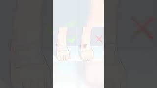 Wound dressing procedure shorts shortsfeed shortsvideo [upl. by Giffy]