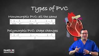 One Quick Question What are PVCs Premature Ventricular Contractions [upl. by Greenburg268]