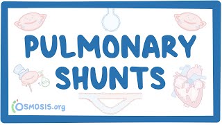 Pulmonary shunts [upl. by Arakawa]