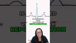 Unveiling the Hidden Signals of ECG Atrial Repolarization Inside the QRS Complex [upl. by Montagna465]