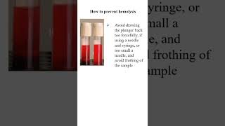 How to prevent hemolysis sample [upl. by Kablesh]