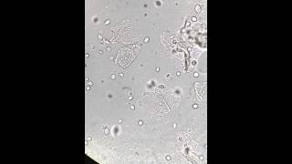 Trichomonas vaginalis in urine at 400x [upl. by Ecinad]