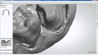 3Shape Model Builder  Crowns and Bridges Demo [upl. by Anide]