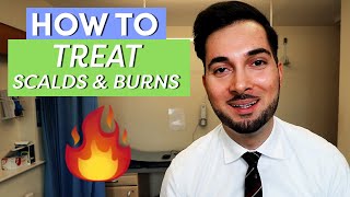 Burns  How To Treat Burns  How To Treat A Burn [upl. by Tamas556]