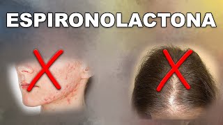 ESPIRONOLACTONA ¿solución ACNÉ y ALOPECIA femenina [upl. by Pulsifer]