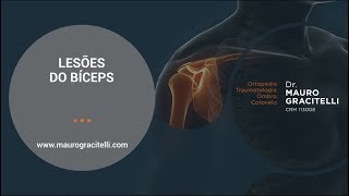 Tendão do bíceps no ombro  tendinites lesão parcial e lesão completa  Entenda tudo sobre [upl. by Arabele353]