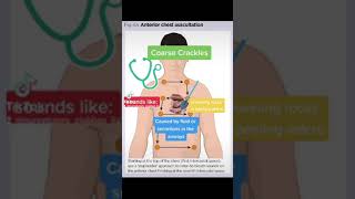 Chest Auscultation Identifying common BreathLung Sounds [upl. by Teahan]