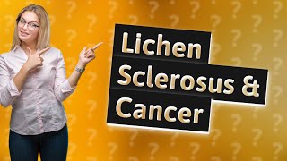 How quickly can lichen sclerosus become cancerous [upl. by Leugar268]