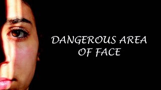 Dangerous area of face [upl. by Combe]