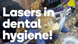 Four ways a dental hygienist can use lasers [upl. by Nomolas]