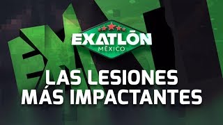 ¡Recordemos las lesiones más impactantes  Exatlón México [upl. by Arley]