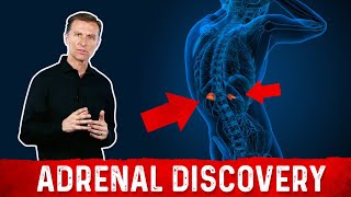 Adrenal Discovery – High Cortisol Levels Blood Sugar Levels amp Adrenal Stress – Dr Berg [upl. by Sucam]