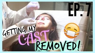 Rhinoplasty at 16 Vlog CAST REMOVAL DAY Episode 7 [upl. by Rolandson956]