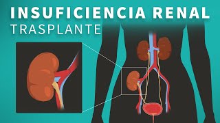 Insuficiencia renal terminal ESRD Causas síntomas y opciones de tratamiento [upl. by Ariam824]