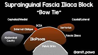 Suprainguinal fascia iliaca nerve block anatomy [upl. by Armando]