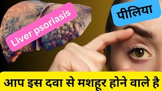 Know Treatment About Jaundice  Hakeem Khalid पीलिया Jaundice का रामबाण घरेलू उपचार । Piliya [upl. by Dolph445]