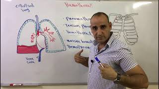 اصابات الصدر المدمى Hemothorax and massive hemothorax [upl. by Ajak]