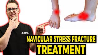 Navicular Stress Fracture Treatment Exercise Shoes amp Stretches [upl. by Zachary317]