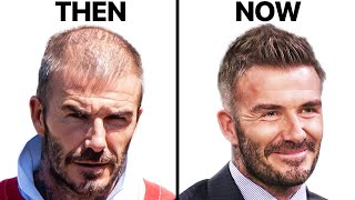 David Beckham How He Stopped Hair Loss [upl. by Einahets282]