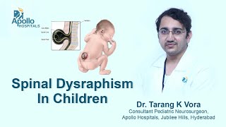 Spinal Dysraphism In Children  Dr Tarang Vora Pediatric Neurosurgeon  Apollo Hospitals Hyderabad [upl. by Giacinta]