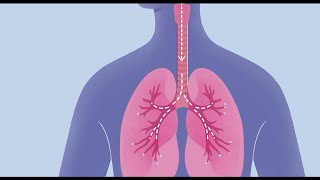 Contact Allergy to Propylene Glycol [upl. by East]