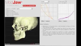 Diagramme de Posselt 3D en vue sagittalavi [upl. by Hackathorn]