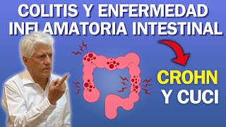 COLITIS y ENFERMEDAD INFLAMATORIA INTESTINAL Crohn y CUCI [upl. by Avon515]