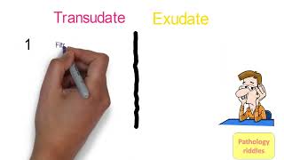 Edema Pathology Part  3 Hemodynamics Transudate versus Exudate Fmge Neet PG usmle Pathology Notes [upl. by Adnoluy239]