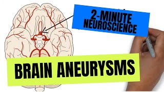 2Minute Neuroscience Brain Aneurysms [upl. by Adekram]