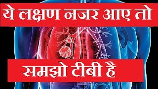 ये लक्षण नजर आए तो समझो टीबी है  what are the symptoms of tuberculosis in lungs  tuberculosis [upl. by Lyontine]