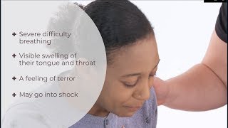 What is anaphylaxis  Anaphylactic shock  First Aid  iHASCO [upl. by Jarad]