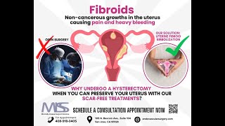 Get Rid of Fibroids Without Losing Your Uterus [upl. by Tiffie]