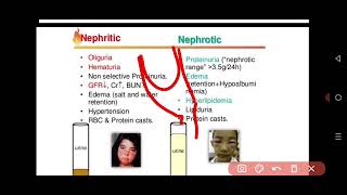 Internal Medicine  Nephrology Glomerulonephritis GN [upl. by Hedwiga]