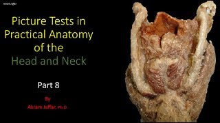 Picture tests in head and neck anatomy 8 [upl. by Pernas409]