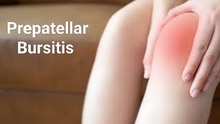 Prepatellar Bursitis Housemaids Knee Rehab Exercises [upl. by Grefer]