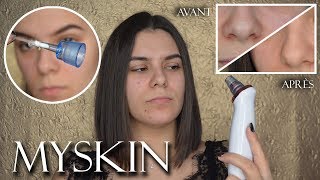 JE TESTE LASPIRATEUR À POINTS NOIRS  MYSKIN [upl. by Tannie109]