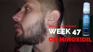 Minoxidil Beard  Week 47  Minoxidil 5 for Beard Growth  Facialfuzzfridays [upl. by Ecidnak]