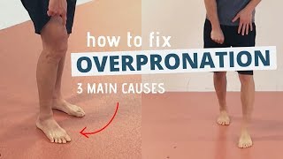 Pronated Feet and How to Fix 3 Different Causes of OVERPRONATION [upl. by Melmon]