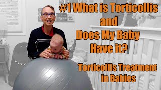 1 What is Torticollis and Does My Baby Have it Torticollis Treatment in Babies [upl. by Nottus]