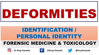 Deformities  Identification  Dr Krup Vasavda [upl. by Ylrebmit]