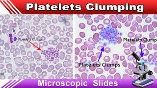 Platelets Clumping  Increase Your Identification Skills [upl. by Leahcimed]