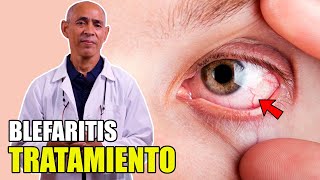 👀 BLEFARITIS Tratamiento Párpados hinchados por uso de PANTALLAS 📵 [upl. by Junius]