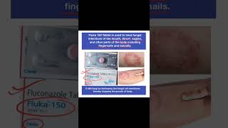 Fluka 150 fungalinfection skincare viralvideo [upl. by Arah901]