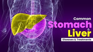 Common Stomach and Liver Diseases and Treatment Hindi  Dr Manoj Kumar Gastroenterology [upl. by Ibbob760]